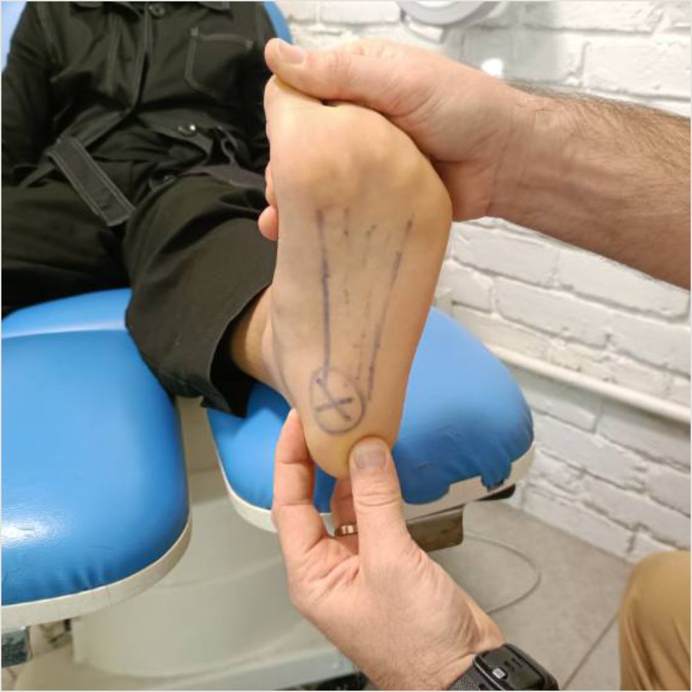 Hell Pain relief in Ferny Hills